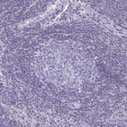 Anti-ZMIZ1 Antibody