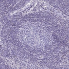 Immunohistochemical staining of human lymph node shows no positivity in germinal center cells as expected.