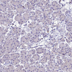 Anti-ZMIZ1 Antibody