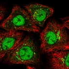 Immunofluorescent staining of human cell line A549 shows localization to nucleoplasm & vesicles.