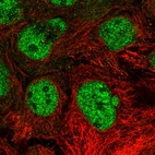 Immunofluorescent staining of human cell line CACO-2 shows localization to nucleoplasm.