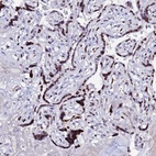 Anti-MYNN Antibody