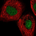 Immunofluorescent staining of human cell line A-431 shows localization to nucleus.