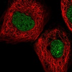 Anti-MYNN Antibody