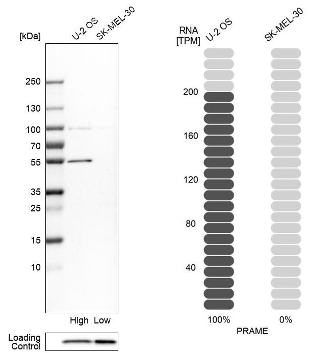 Anti-PRAME Antibody