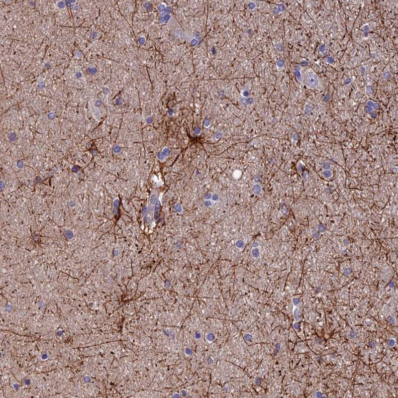Anti-USP37 Antibody