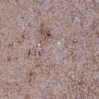 Anti-USP37 Antibody