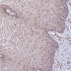 Anti-POLR2I Antibody