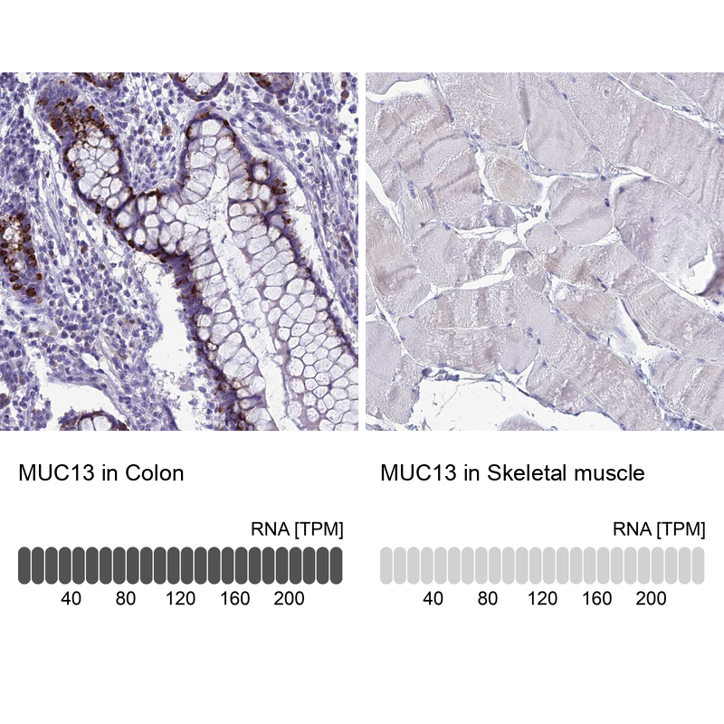 Anti-MUC13 Antibody