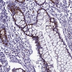 Immunohistochemical staining of human colon shows strong membranous-cytoplasmic positivity in goblet cells.