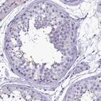 Immunohistochemical staining of human testis shows moderate membranous positivity in spermatids.