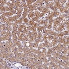 Anti-ASPHD1 Antibody