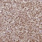 Anti-DDB1 Antibody