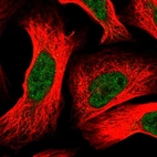 Immunofluorescent staining of human cell line U-2 OS shows localization to nucleoplasm.
