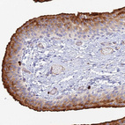 Anti-VAT1 Antibody