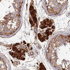 Immunohistochemical staining of human testis shows strong cytoplasmic positivity in Leydig cells.