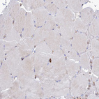 Immunohistochemical staining of human skeletal muscle shows no positivity in myocytes as expected.