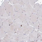 Immunohistochemical staining of human skeletal muscle shows no positivity in myocytes as expected.