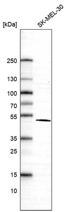 Western blot analysis in human cell line SK-MEL-30.