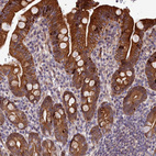 Anti-ABCB8 Antibody