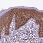 Immunohistochemical staining of human skin shows strong cytoplasmic positivity in squamous epithelial cells.