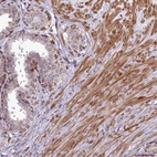 Immunohistochemical staining of human prostate shows moderate cytoplasmic positivity in smooth muscle cells and in a subset of glandular cells.