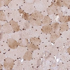 Immunohistochemical staining of human skeletal muscle shows strong nuclear membrane and weak cytoplasmic staining in myocytes.