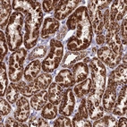 Anti-PSMD2 Antibody