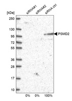 Anti-PSMD2 Antibody