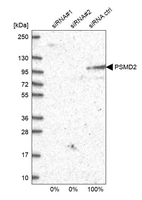 Western blot analysis in U2OS cells transfected with control siRNA, target specific siRNA probe #1 and #2, using Anti-PSMD2 antibody. Remaining relative intensity is presented.