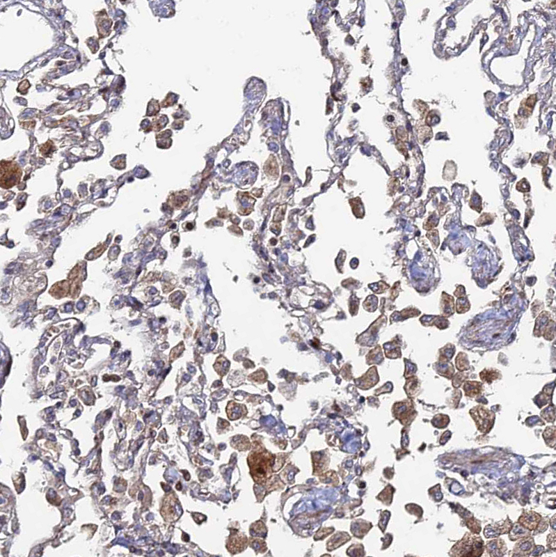 Anti-SGMS1 Antibody