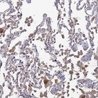 Anti-SGMS1 Antibody