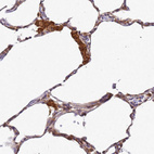 Anti-ADPGK Antibody