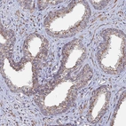 Immunohistochemical staining of human prostate shows moderate granular cytoplasmic positivity in glandular cells.