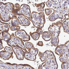 Anti-ADPGK Antibody