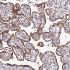 Immunohistochemical staining of human placenta shows moderate granular cytoplasmic positivity in trophoblastic cells.