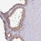 Anti-ADPGK Antibody