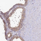 Immunohistochemical staining of human prostate shows moderate granular cytoplasmic positivity in glandular cells.