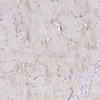 Immunohistochemical staining of human skeletal muscle shows no positivity in myocytes as expected.