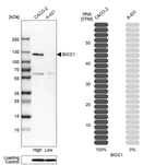 Anti-BICC1 Antibody