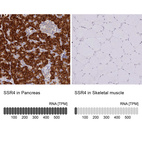 Anti-SSR4 Antibody