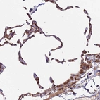 Anti-MEOX1 Antibody