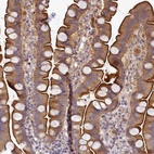 Anti-TMEM74B Antibody