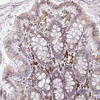 Immunohistochemical staining of human colon shows moderate to strong cytoplasmic positivity in lymphoid cells.