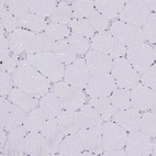Immunohistochemical staining of human skeletal muscle shows no positivity in myocytes as expected.