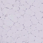 Immunohistochemical staining of human skeletal muscle shows no positivity in myocytes as expected.