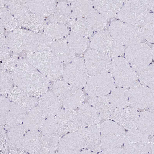 Anti-SSR4 Antibody