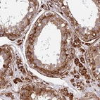 Anti-NDUFAF7 Antibody