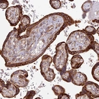 Immunohistochemical staining of human placenta shows strong cytoplasmic positivity in trophoblastic cells.