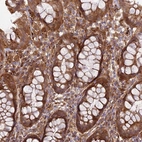 Immunohistochemical staining of human rectum shows strong cytoplasmic positivity in glandular cells.